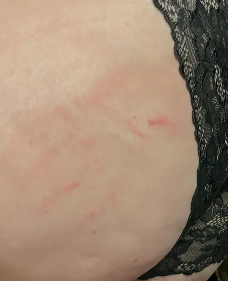 Annalisa, 28 anni